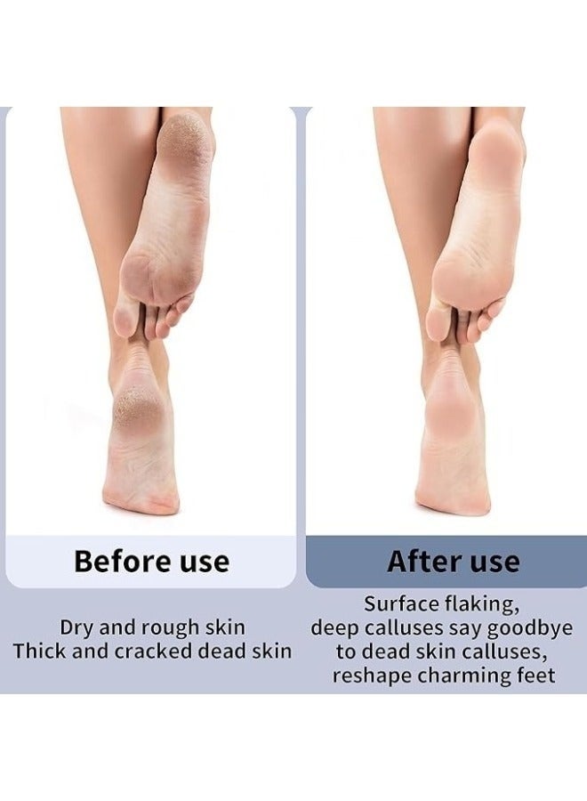 هابي هوم جهاز تقشير القدم الكهربائي - 2 رؤوس، شحن USB، لإزالة الجلد الميت وتنعيم القدمين - Image 4